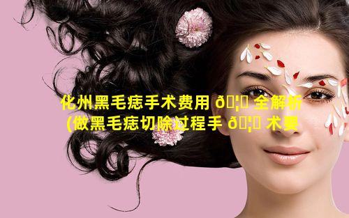 化州黑毛痣手术费用 🦅 全解析(做黑毛痣切除过程手 🦆 术要住院多少天)